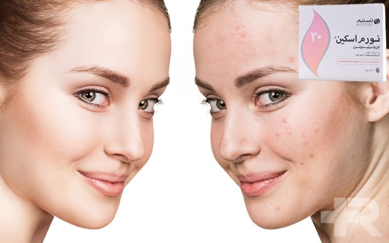 قرص نورم اسکین