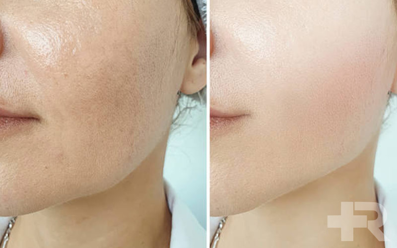 بررسی نظرات مصرف کنندگان پودر کلاژن از اهمیت زیادی برای مصرف کنندگان برخوردار است.