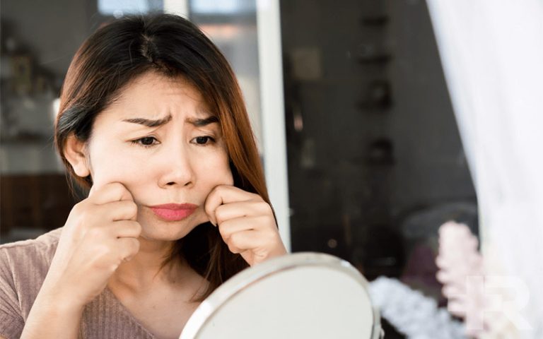 چاق شدن صورت و زیر چشم