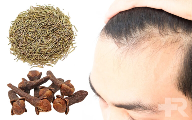 میخک و رزماری برای مو