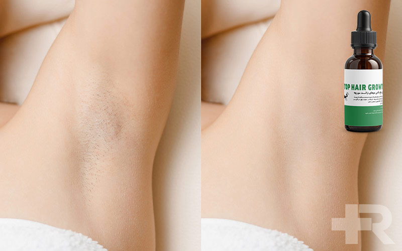 نظرات درباره روغن مورچه بسیار متفاوت است که در این مطلب به صورت کامل بیان شده است.