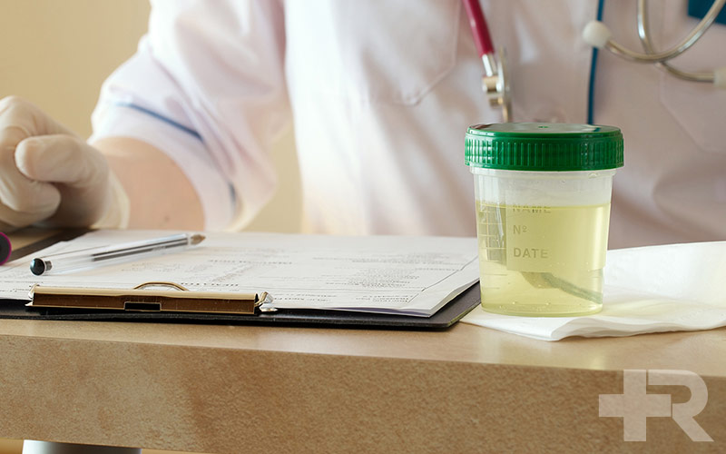 ادرار به رنگ آب نشانه چیست؟